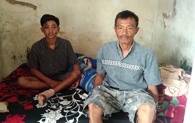 Cerita Ibu Korban Tragedi Kanjuruhan, Nekat Utang Demi Rawat Anaknya di Rumah 