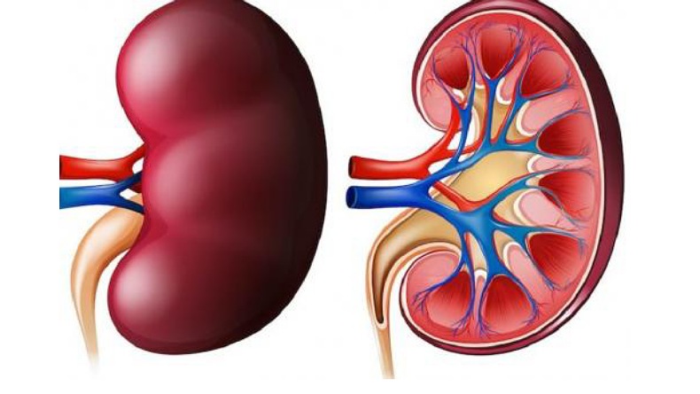 8 Pasien Gagal Ginjal Akut Masih Dirawat di RS Cipto Mangunkusumo