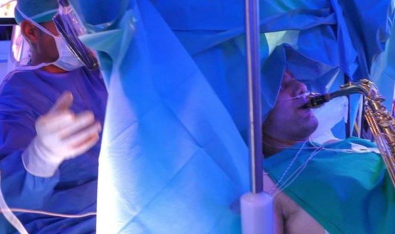 Wow, Pasien Ini Jalani Operasi Pengangkatan Tumor di Otak Sambil Main Saksofon