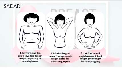 Mudah Dilakukan, Ini 4 Cara Deteksi Dini Kanker Payudara 