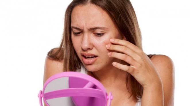 Musim Hujan Kulit Wajah Makin Kering dan Kusam, Ini Perawatan yang Bisa Dilakukan 