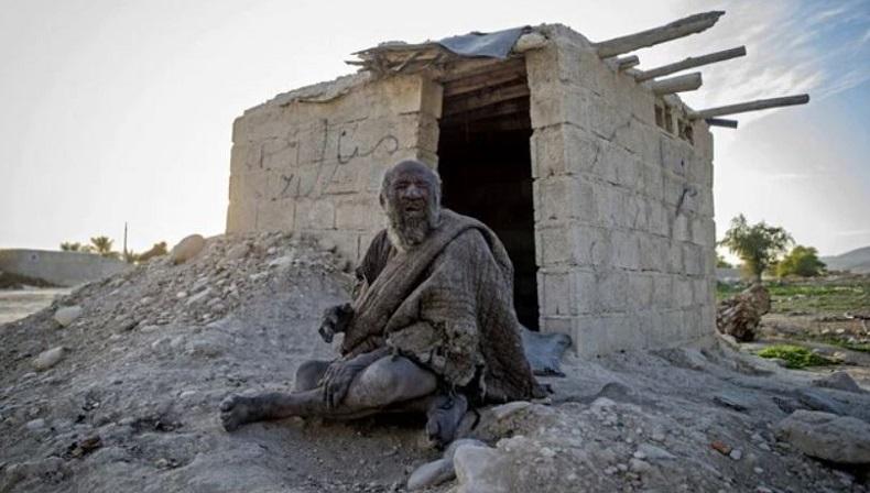 Manusia Paling Kotor di Dunia yang Suka Makan Daging Busuk Meninggal di Usia 94 Tahun 