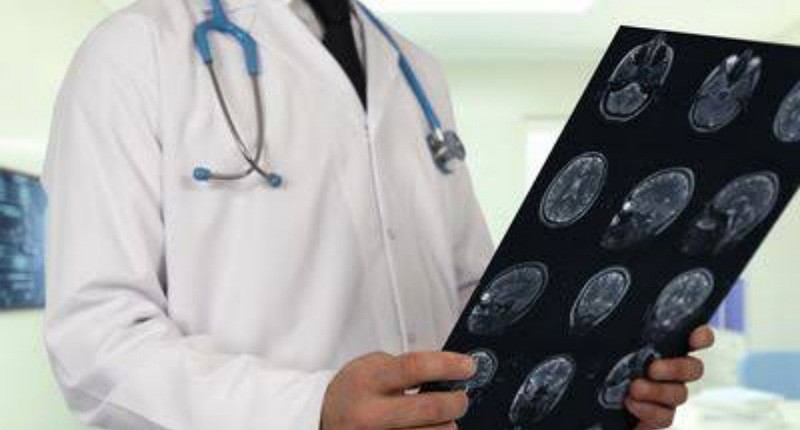 Kenali Jenis Stroke dan Penanganannya, Jangan Sampai Terjadi Kecacatan