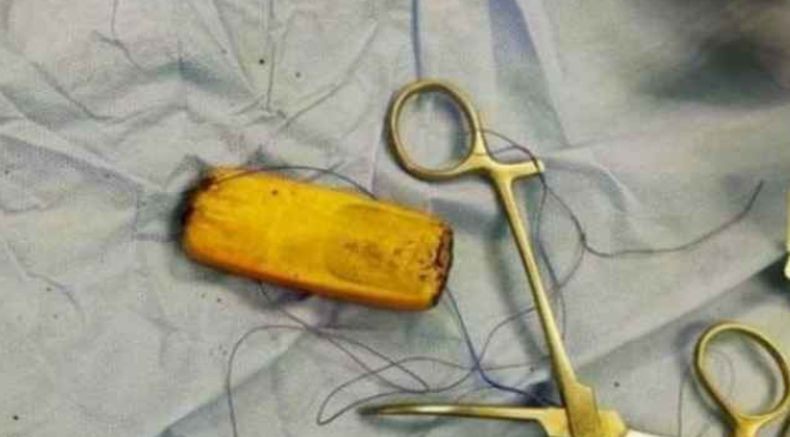 Napi Ini Nekat Telan Ponsel untuk Dipakai di Penjara, Ujungnya malah Menderita