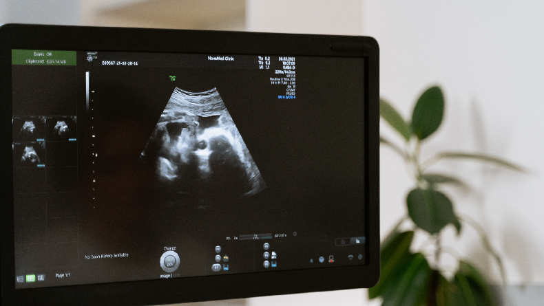 Teknologi yang Menggunakan Ultrasonik dalam Berbagai Bidang, Yuk Simak!