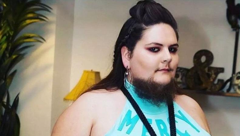 Salut, Perempuan Ini Tetap PD Punya Jenggot Lebat di Wajah