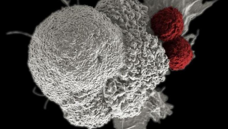 Kenali Perbedaan Kanker dan Tumor, 2 Penyakit yang Mematikan Bila Terlambat Ditangani