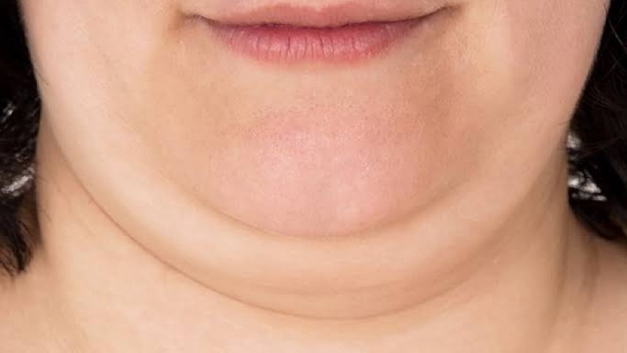 Tak Perlu Keluar Biaya, Begini 3 Cara Menghilangkan Double Chin dengan Mudah
