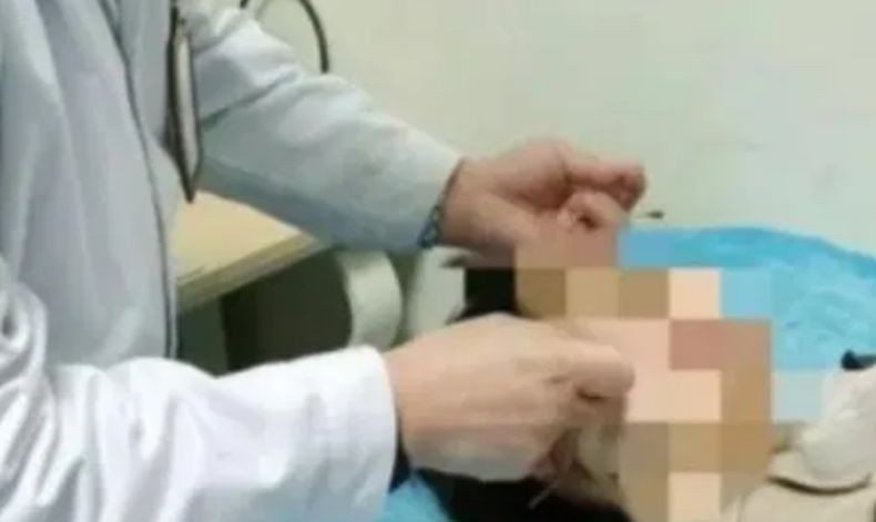 Begadang Seminggu Nonstop Nonton Piala Dunia, Wajah Pria Ini Lumpuh