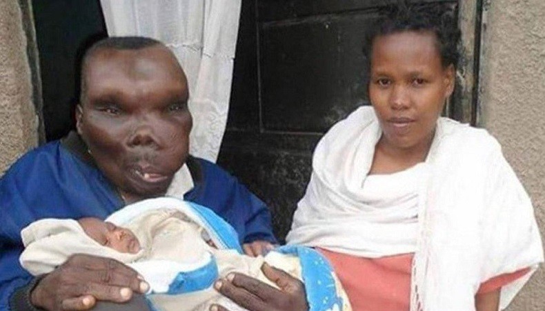 Godfrey Baguma, Pria Terjelek di Dunia tapi 3 Kali Menikah dan Punya 8 Anak