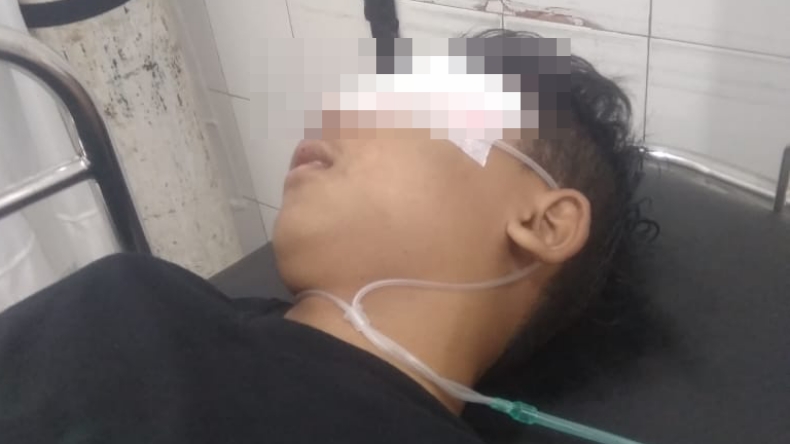 Tunggu Jemputan Pulang Sekolah, Siswa SMP di Jogja Dibacok 