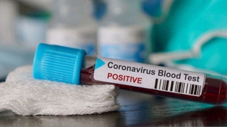 Kasus Covid-19 di Amerika Serikat Melonjak, Mayoritas Pasien di Atas 65 Tahun