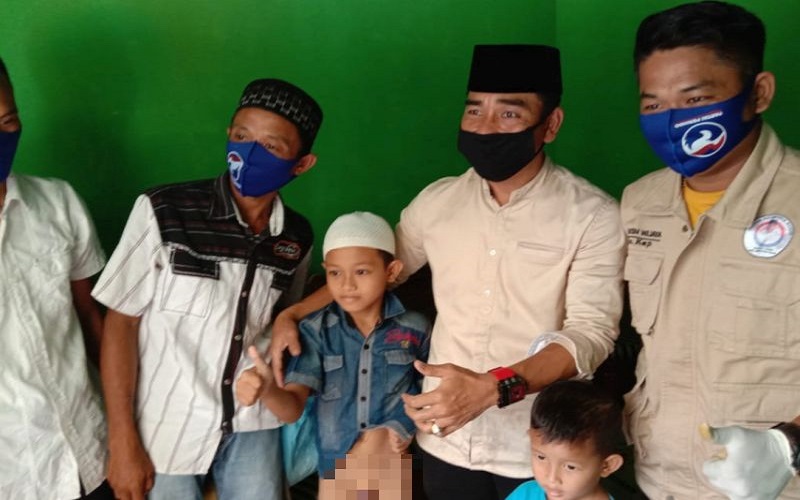  Anggota DPRD Muba dari Partai Perindo Gelar Khitanan Massal Gratis