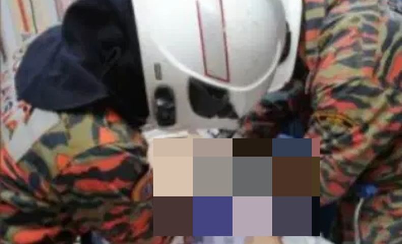 Cincin Terjebak di Alat Kelamin Pria Ini, Pemadam Kebakaran Turun Tangan