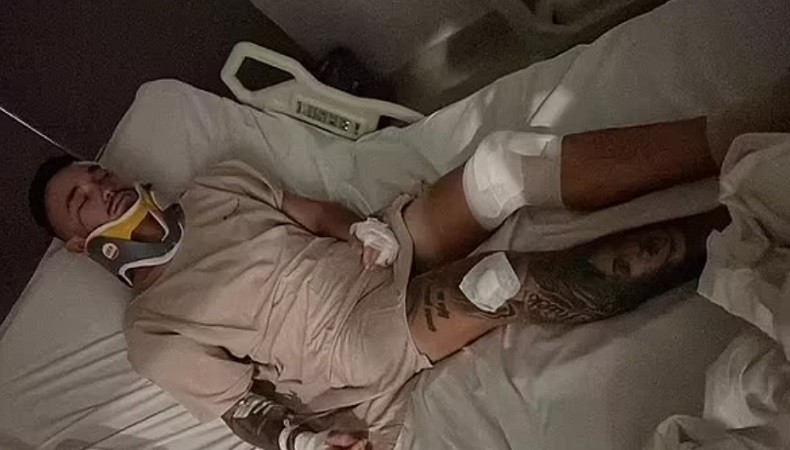 Bule Australia Ngaku Dirampok dan Dianiaya di Bali, Polda Bali Ungkap Fakta Sebenarnya