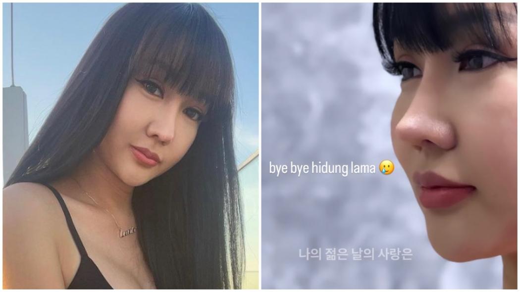 Tak Puas, Lucinta Luna Bakal Jalani Operasi Plastik Lagi: Bedah Wujud Season 3