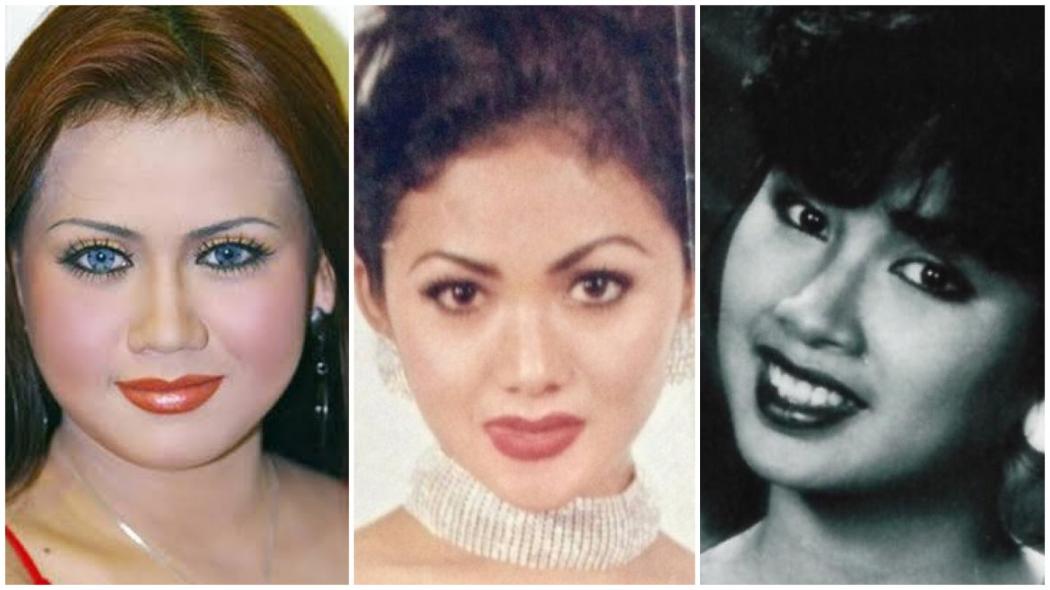 Deretan Artis Lawas Jalani Operasi Plastik, Ada yang Rela Rogoh Kocek hingga Miliaran Rupiah