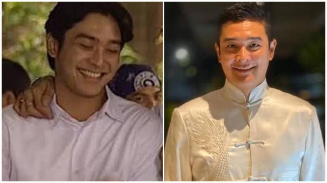 Cerita Artis Lawas Era 1990-an Irgi Fahrezi Lawan Penyakit Stroke, Akui Sempat Terlambat Dibawa ke RS