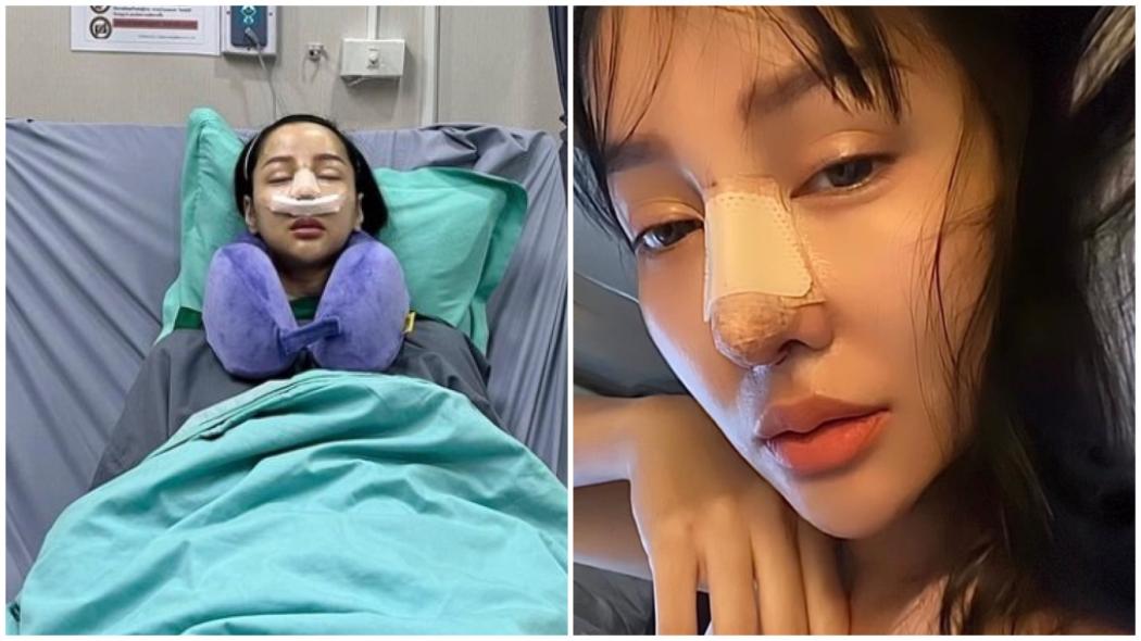 Tak Kapok Oplas Lagi, Lucinta Luna Pamer Hidung Baru: Lunalisa