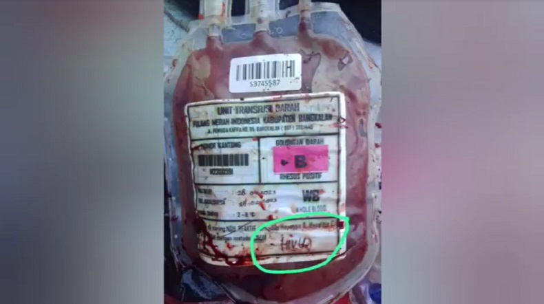 Ngeri, Puluhan Kantong Darah Bertuliskan HIV Berserakan di Tempat Sampah Bangkalan