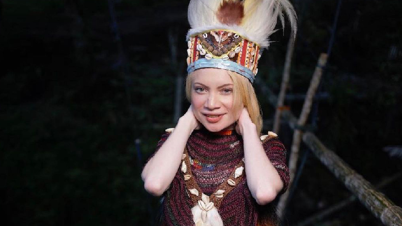 Potret Herolena, Gadis Albino asal Papua Barat yang Mirip Barbie Hidup
