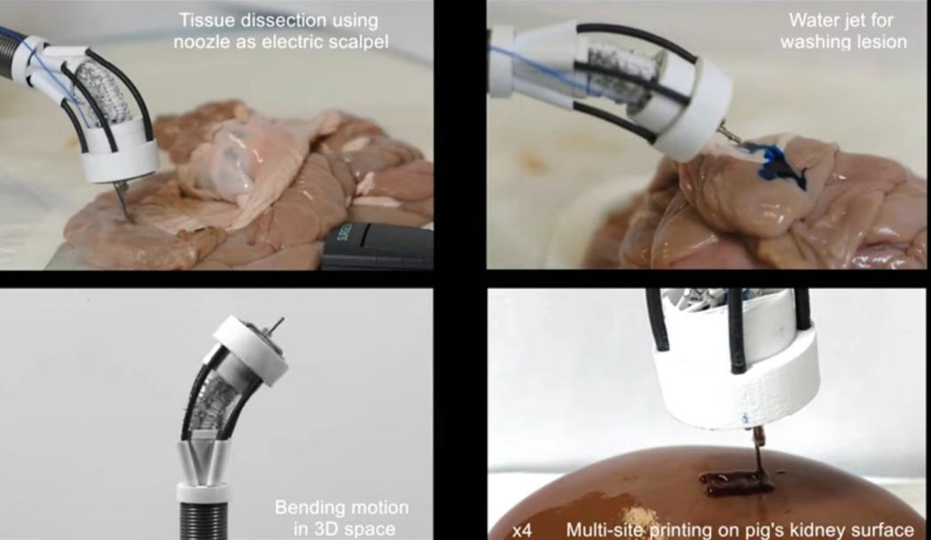 Canggih Peneliti di Australia Temukan Printer 3D Bisa Perbaiki Jaringan Tubuh