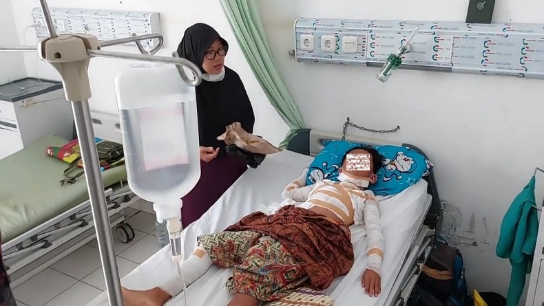 Gegara Bermain Petasan Spiritus, Bocah 10 Tahun di Tanjungsiang Subang Terbakar