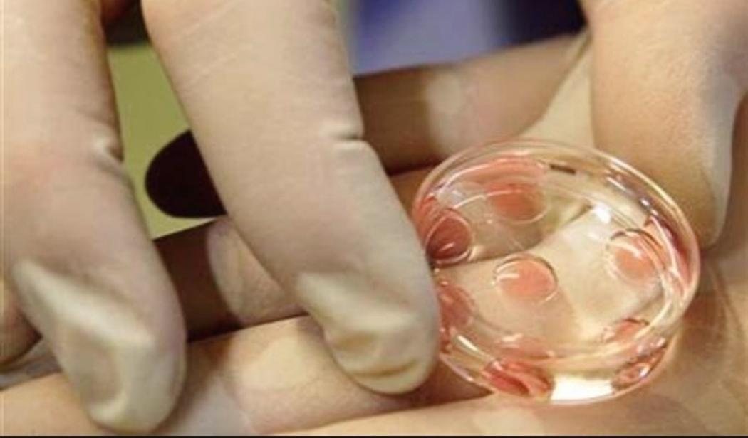 Heboh Pria Ini Memiliki Lebih 500 Anak dari Banyak Perempuan, Hasil Donor Sperma