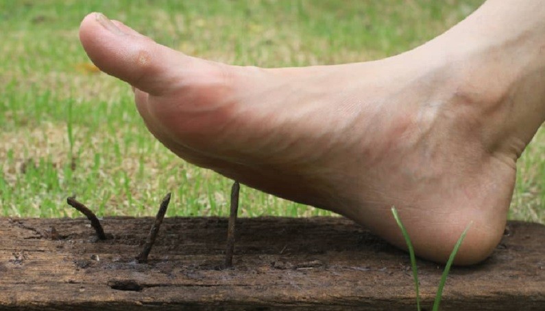 Cara Mengobati Kaki Kena Paku dengan Bawang Merah, Aman atau Justru Berbahaya?