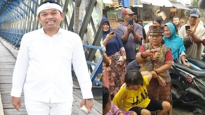 Pro Kontra Pengobatan ala Ibu Ida Dayak, Ini Kata Dedi Mulyadi