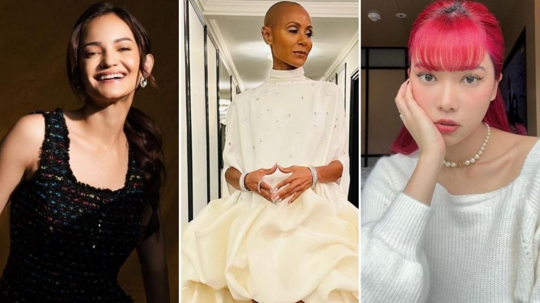 Deretan Artis Mengidap Autoimun selain Isyana Sarasvati, Nomor 4 hingga Kepalanya Botak