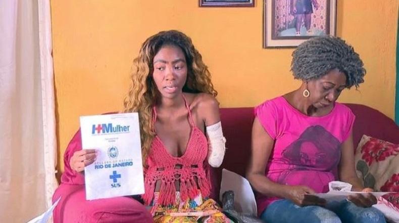 Penari Samba Ini Kehilangan Lengan Kiri Pascaoperasi Rahim, kok Bisa?