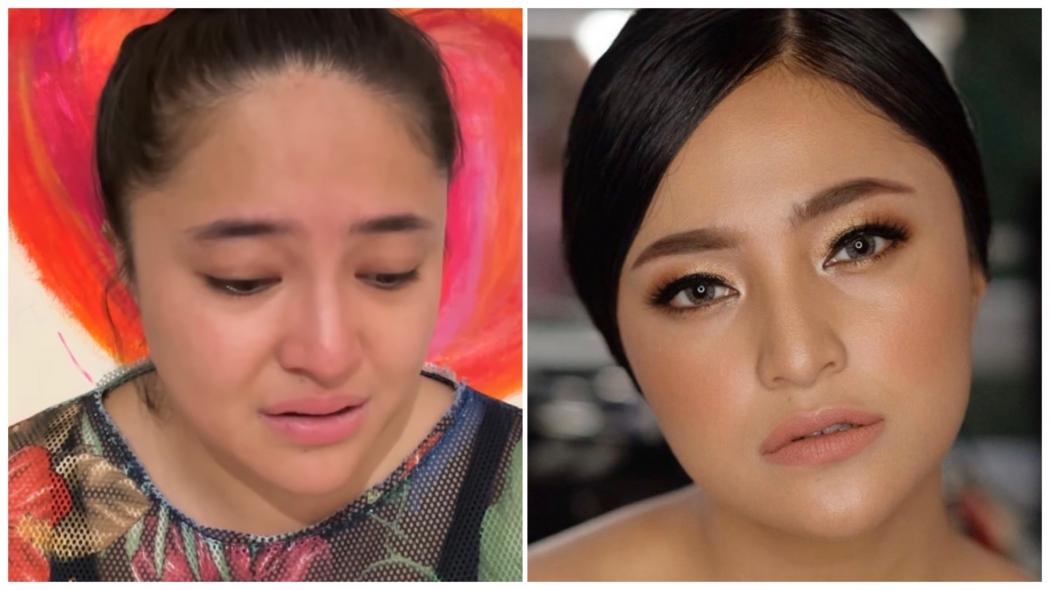 Marshanda Bagikan Curhatan Pilu tentang Kondisi Kesehatannya, Ada Tumor Baru hingga Penurunan Fungsi Hati