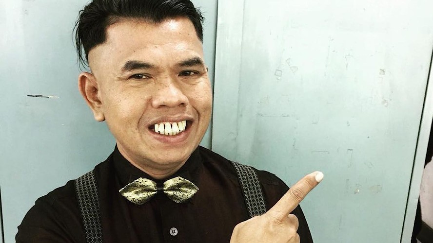 Innalillahi, Benjo Eks Teamlo Meninggal Dunia Hari Ini