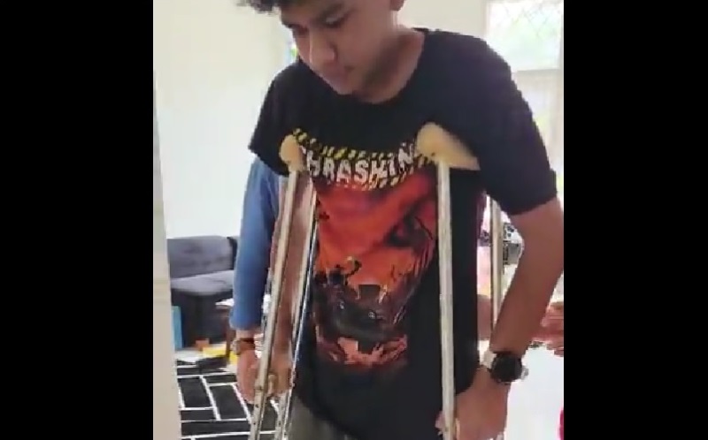 David Ozora Kembali Dirawat karena Pergelangan Kaki Retak Buntut Dianiaya Mario Dandy