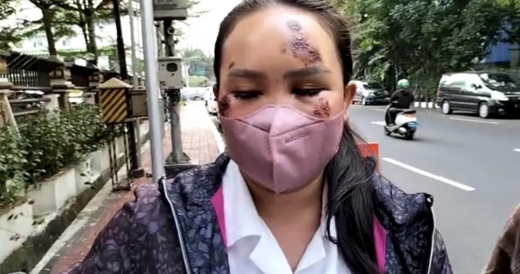 Polisi Usut Kasus Viral Ambar Ditabrak Pacar, Sejumlah Saksi Diperiksa
