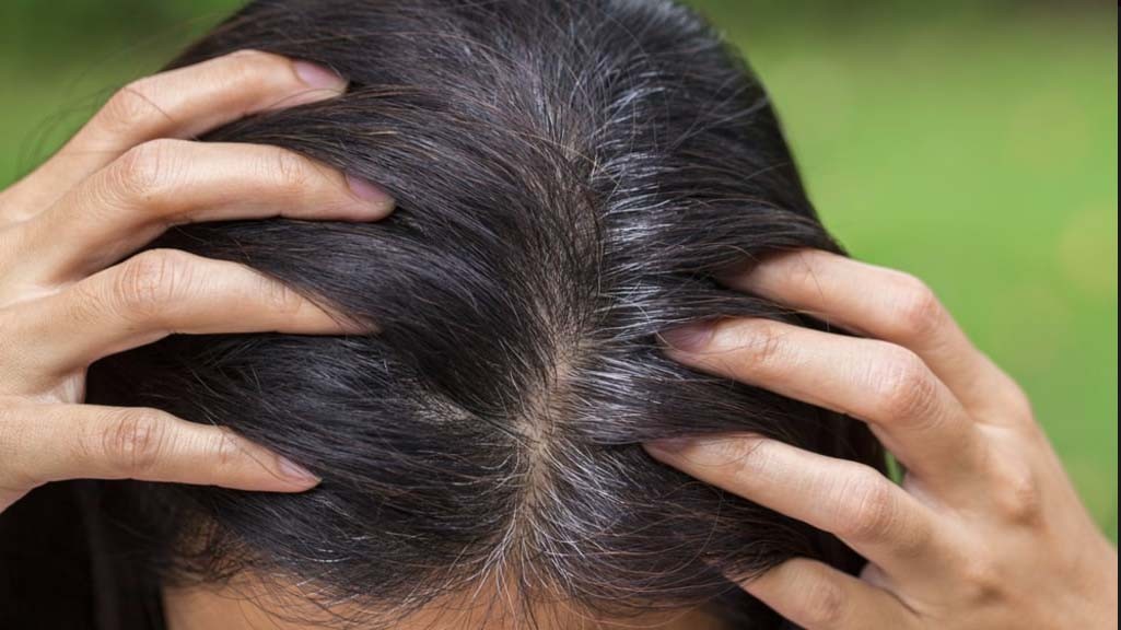 5 Penyebab Orang Cepat Beruban, Bisa karena Merokok hingga Stres