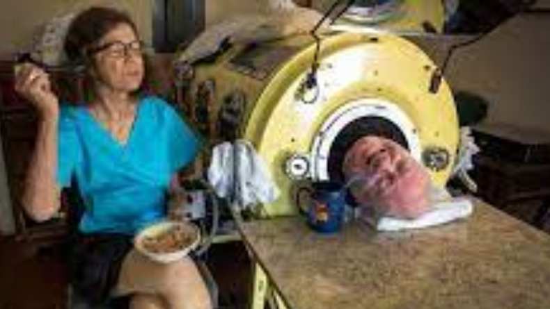 Paul Alexander, Pria yang Hidup dengan Paru-paru Besi Lebih dari 70 Tahun setelah Terkena Virus Polio