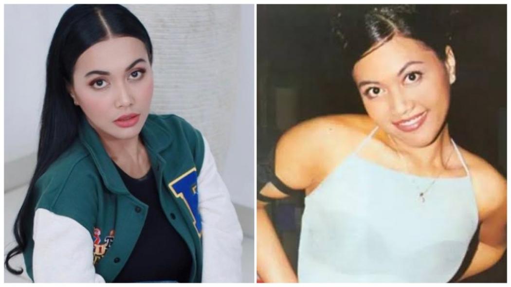 Denada Ungkap Alasan Lakukan Oplas di Korea Selatan: Insecure Itu Pasti