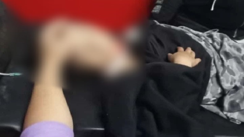 Leher Anak Perempuan 4 Tahun di Banyuresmi Garut Luka Parah Terjerat Benang Layangan