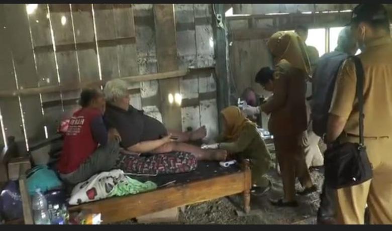 Pria Obesitas 200 Kg yang Sempat Dievakuasi dari Jakarta Tiba di Rumah Grobogan 