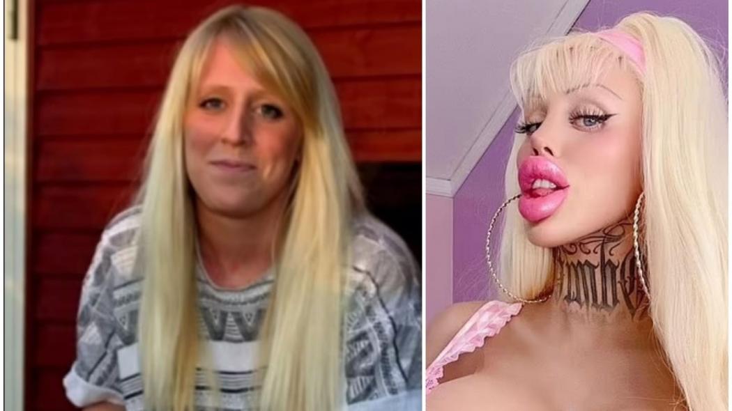 Habiskan Rp2 Miliar Demi Jadi Barbie Hidup Malah Dihina, Begini Wajah Perempuan Ini Sekarang