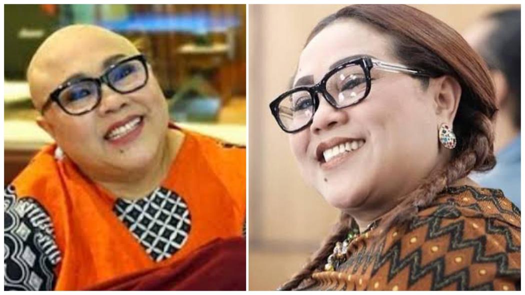 Begini Kabar Terbaru Nunung Srimulat usai Operasi Kanker Payudara, Bahagia Lihat Rambutnya Tumbuh Lagi