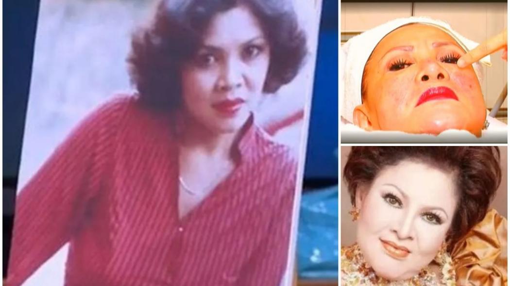 Kisah Artis Lawas yang Suntik Silikon sejak Usia 20-an, Sempat Menyesal Lihat Wajahnya