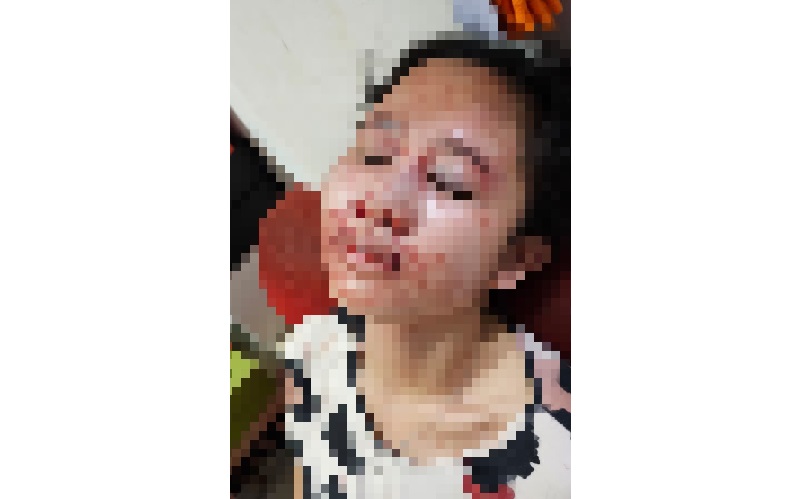 Suami Tega Aniaya Istri yang Hamil 4 Bulan di Serpong, Pelaku Tak Ditahan meski Jadi Tersangka