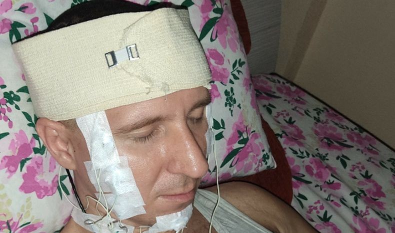 Nyeleneh, Ilmuwan Ini Bedah Otak Sendiri Pasang Alat untuk Kendalikan Mimpi