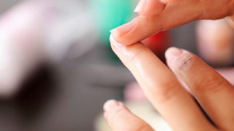5 Cara Memutihkan Kuku yang Kuning, Bisa Dilakukan di Rumah