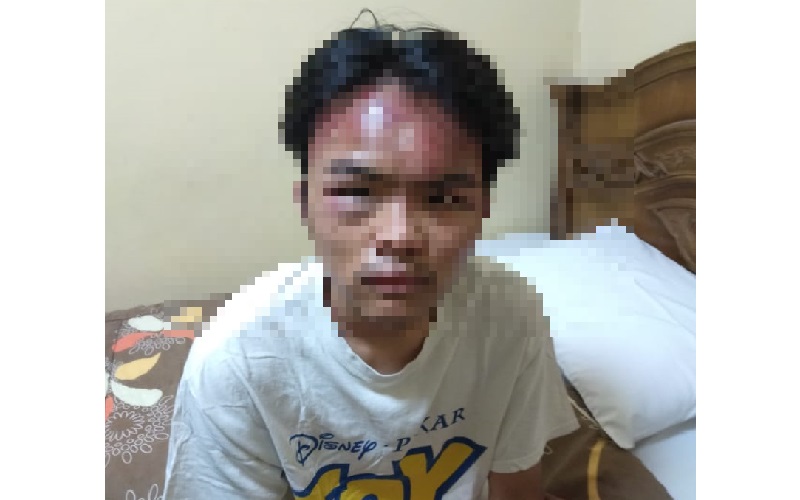 Mahasiswa Indonesia Babak Belur Dianiaya di Mesir, IKANU Minta Pelaku Ditindak Tegas