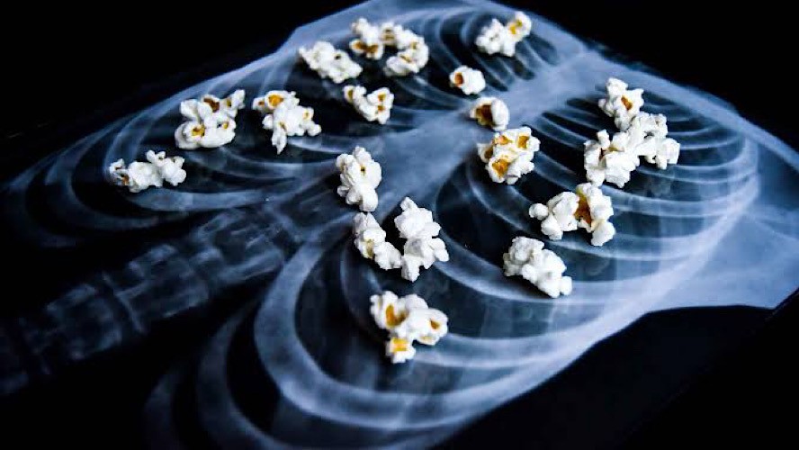 Waspadai Bahaya Vape Bagi Kesehatan Paru-Paru, Bisa Sebabkan Popcorn Lung