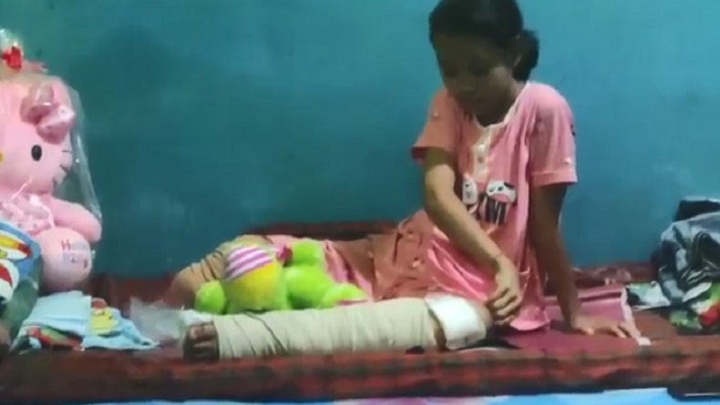 Viral Kisah Nabila Tertabrak Truk demi Selamatkan Kucing, Kini Satu Kakinya Diamputasi